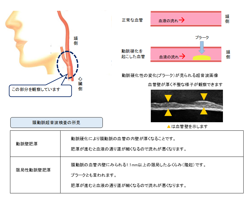 ココナッツオイルは勃起不全を助けますか？